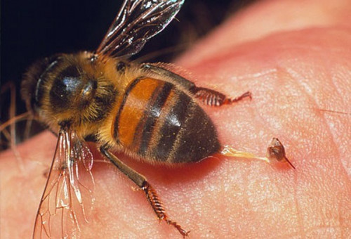 thoat hiem khi bi ong chich (4)
