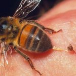 thoat hiem khi bi ong chich (4)
